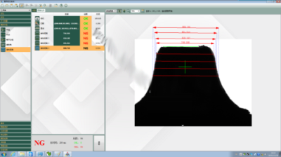 齿轮磨损视觉检测系统系统-机器视觉_视觉检测设备_3D视觉_缺陷检测